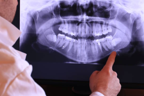 Best Cracked Tooth Emergency Dentist  in Bremen, OH